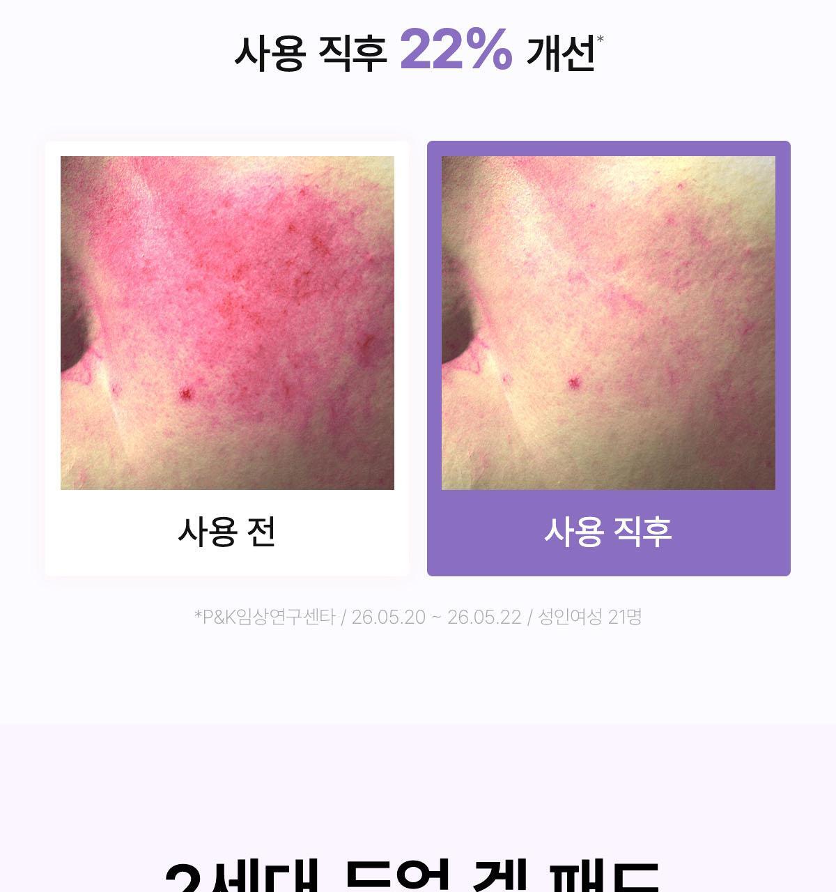 韓國 Biodance Caviar PDRN Dual Gel Toner Pads 高濃度魚子醬PDRN雙重凝膠爽膚濕敷果凍棉片 - 60片裝